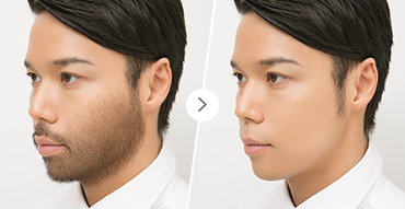 {ヒゲ剃り要らずの肌へ。清潔感UP!}